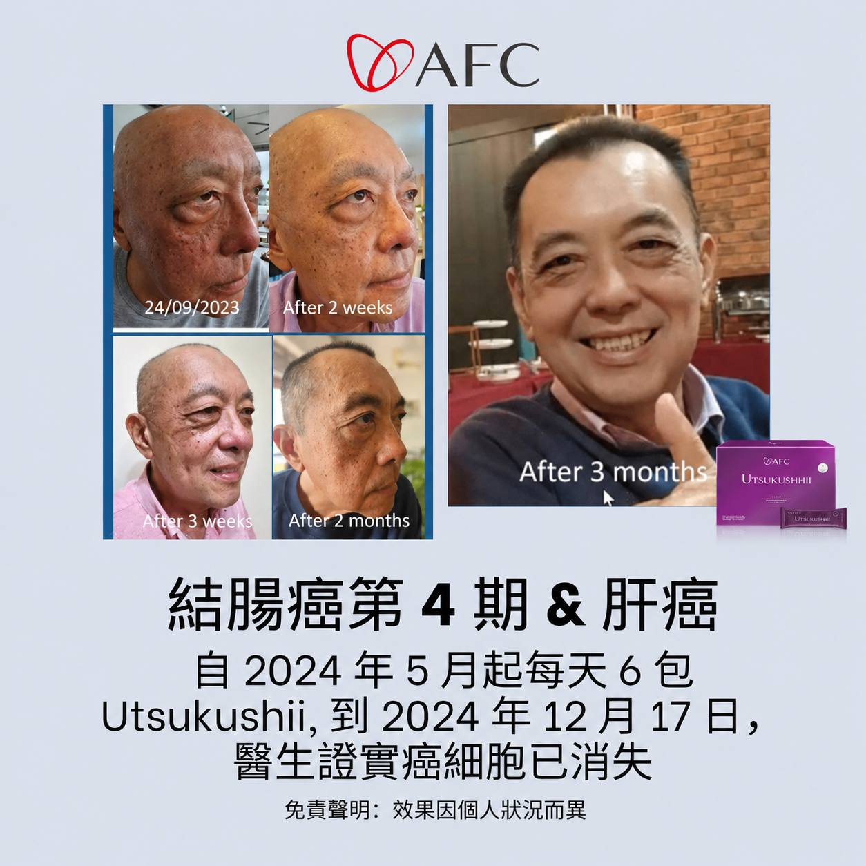 AFC 使用者個人經驗分享